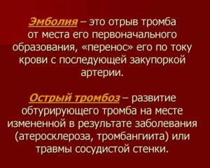 Эмболия отрыв тромба